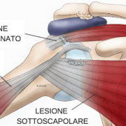 PERIARTITE SCAPOLO OMERALE E OSTEOPATIA 2