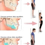 postura malocclusione dentista ortodonzista termoli