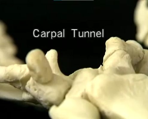 tunnel carpale osteopatia