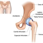 Anca artrosi osteopata milano
