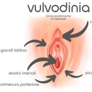 vulvodinia